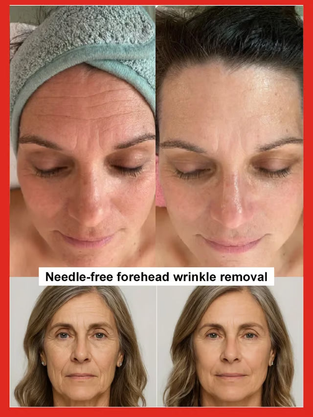 🔥Flash Sale⚡ 50K+ SOLD! Salmon Water Light Anti-Wrinkle Essence